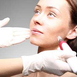 MICRONEEDLING