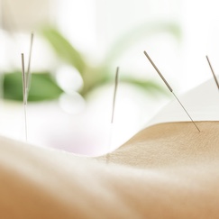 LUXE ACUPUNCTURE