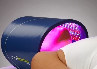 HOLISTIC INTEGRATIVE MICRO- NEEDLING W/ LED LIGHT THERAPY