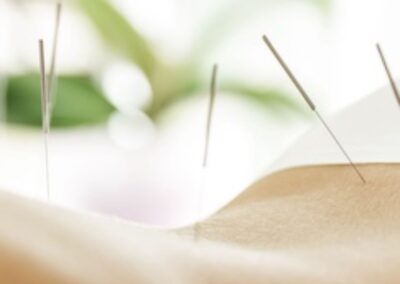 LUXE ACUPUNCTURE