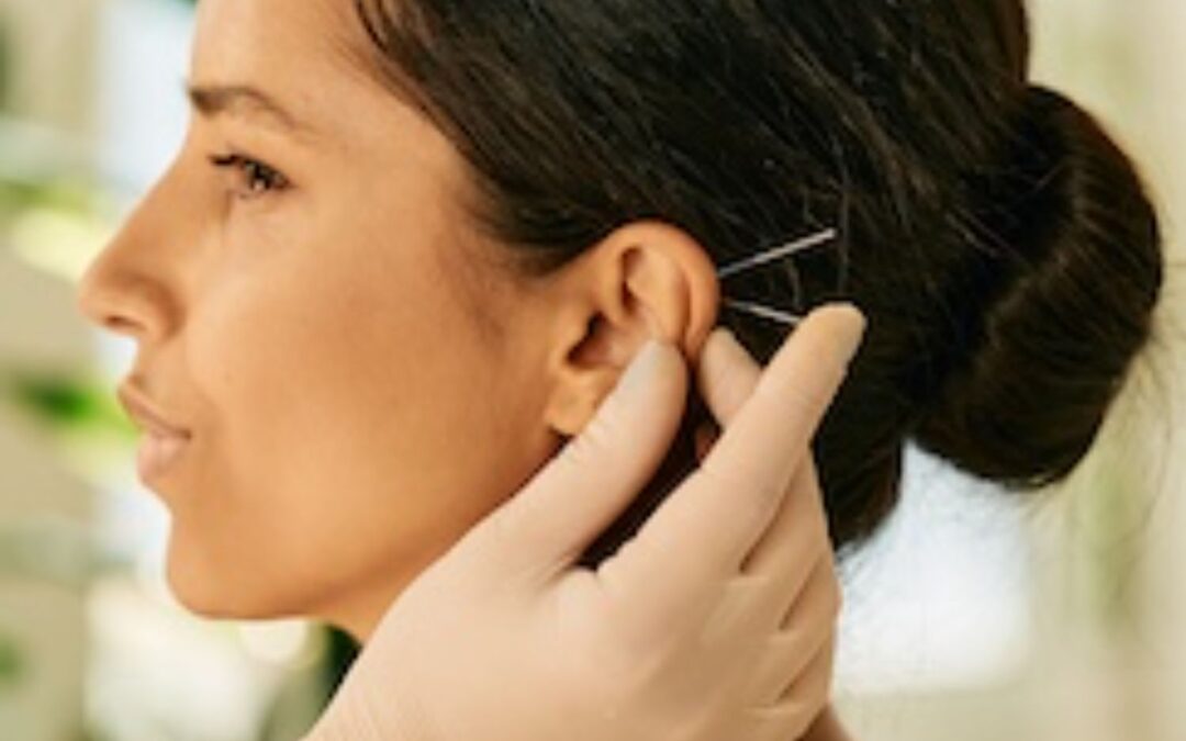 LOUNGE EAR ACUPUNCTURE