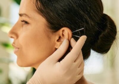 LOUNGE EAR ACUPUNCTURE