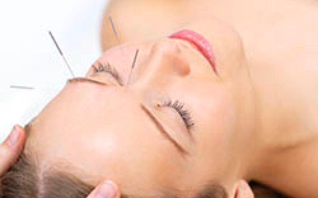 STANDARD FACIAL REJUVENATION ACUPUNCTURE
