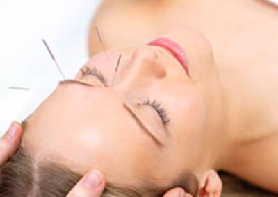 STANDARD FACIAL REJUVENATION ACUPUNCTURE