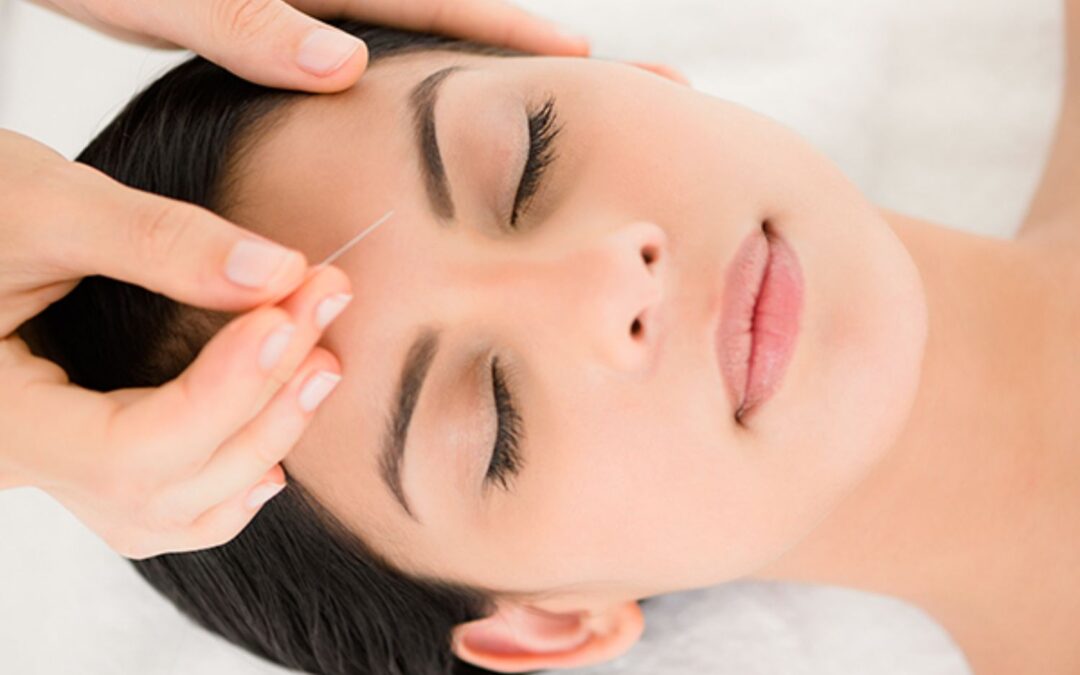 ENHANCED FACIAL REJUVENATION ACUPUNCTURE