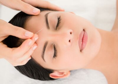 ENHANCED FACIAL REJUVENATION ACUPUNCTURE