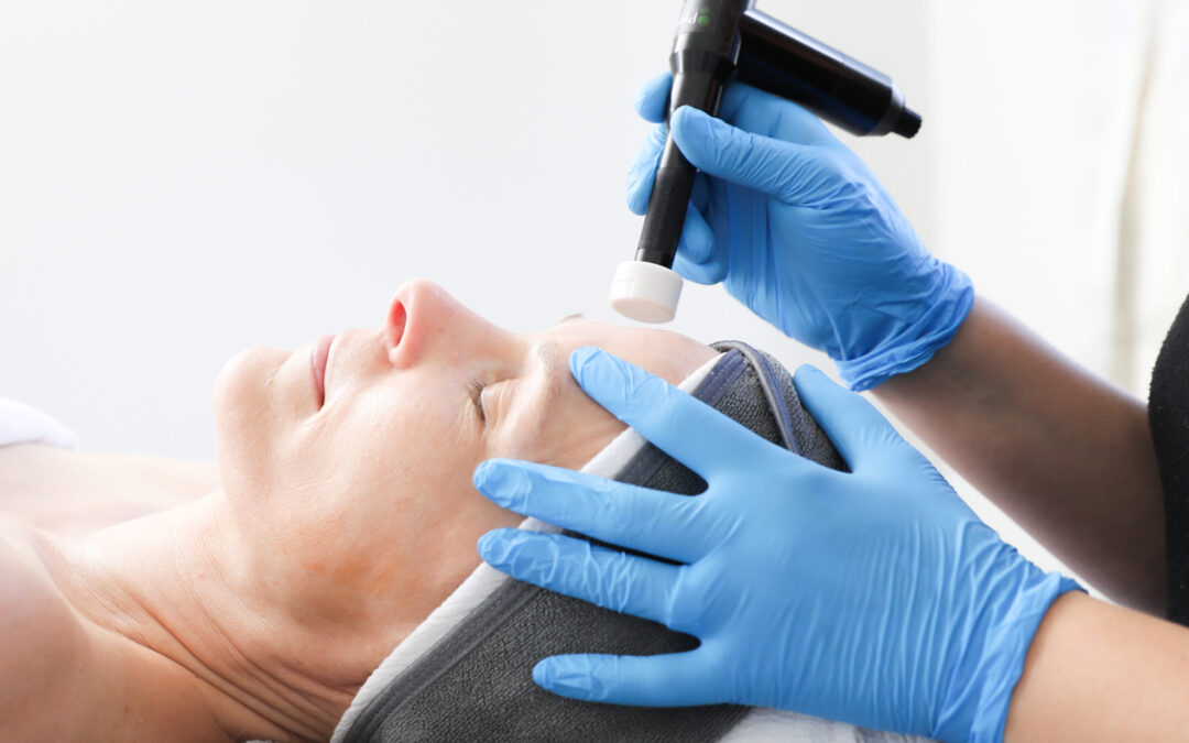 HOLISTIC INTEGRATIVE MICRONEEDLING