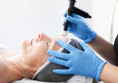 HOLISTIC INTEGRATIVE MICRONEEDLING